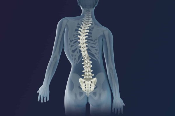 3D_Medical_Animation_scoliosis_Intervertibral_Disc